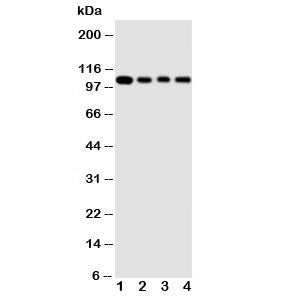 Western blot testing of HSP105 antibody and Lane 1: rat ovary ; 2: A549 cell lysate; 3: U87 cell lysate; 4: HeLa cell lysate. Expected molecular weight: 105-110 kDa.