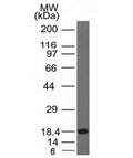 Western blot of a recombinant protein fragment with c-Kit antibody (KIT/983).