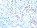 IHC staining of FFPE human lung tissue with Mannose Receptor antibody (clone MRC1/9457). Inset: PBS used in place of primary Ab (secondary Ab negative control). HIER: boil tissue sections in pH 9 10mM Tris with 1mM EDTA for 20 min and allow to cool before testing.
