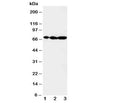 Western blot testing of MEKK2 antibody and Lane 1: rat brain; 2: rat testis; 3: rat lung tissue lysate