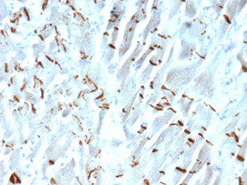 IHC staining of FFPE human heart tissue with Cadherin 2 antibody (clone CDH2/9490). HIER: boil tissue sections in pH 9 10mM Tris with 1mM EDTA for 20 min and allow to cool before testing.