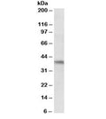 Western blot testing of Daudi lysate with AIM2 antibody at 0.3ug/ml. Predicted molecular weight ~39kDa.