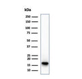 Western blot testing of human HepG2 cell lysate using recombinant CDKN2A antibody (clone CDKN2A/7081R). Predicted molecular weight ~16 kDa.