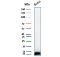 Western blot testing of human brain tissue lysate using S100B antibody (clone 4C4.9). Predicted molecular weight: 12-15 kDa.
