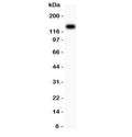 Western blot testing of Integrin beta 1 antibody and HeLa lysate; Predicted molecular weight: 88/130~150 kDa (unmodified/glycosylated).