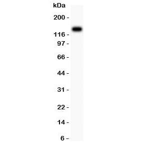 Western blot testing of Integrin beta 1 antibody and HeLa lysate; Predicted molecular weight: 88/130~150 kDa (unmodified/glycosylated).