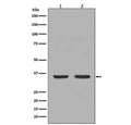 Western blot testing of 1) mouse thyroid and 2) human HeLa lysate with NGF antibody. Predicted molecular weight ~27 kDa (dimer).