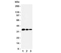 Western blot testing of T-bet antbody and human recombinant protein, 35KD with tag; Lane 1: 5ng; 2: 2.5ng; 3: 1.25ng