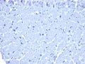 IHC staining of FFPE human heart tissue with mouse IgG1 antibody (clone ICG1/ 1331). HIER: boil tissue sections in pH 9 10mM Tris with 1mM EDTA for 20 min and allow to cool before testing. No staining was observed.