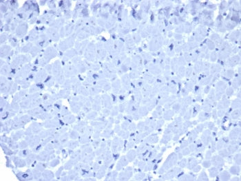 IHC staining of FFPE human heart tissue with mouse IgG1 antibody (clone ICG1/ 1331). HIER: boil tissue sections in pH 9 10mM Tris with 1mM EDTA for 20 min and allow to cool before testing. No staining was observed.