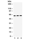 Western blot testing of 1) rat liver, 2) rat kidney, 3) human SW620 lysate with HNF1 beta antibody. Predicted/observed molecular weight ~61 kDa.