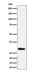 Western blot testing of human LnCaP cell lysate with N-acetyltransferase 1 antibody. Predicted molecular weight ~34 kDa.