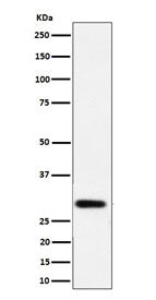 Western blot testing of human LnCaP cell lysate with N-acetyltransferase 1 antibody. Predicted molecular weight ~34 kDa.