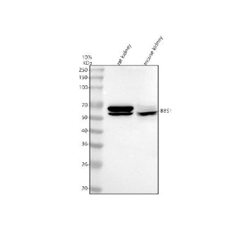 Western blot analysis of BBS1 using anti-BBS1 antibody. Lane 1: rat kidney tissue lysates, Lane 2: mouse kidney tissue lysates. After electrophoresis, proteins were transferred to a nitrocellulose membrane at 150 mA for 50-90 min. Blocked the membrane with 5% non-fat milk/TBS for 1.5 hour at RT.