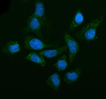 Immunofluorescent staining of LSM14A using anti-LSM14A antibody (green). LSM14A was detected in an immunocytochemical section of HELA cells. Enzyme antigen retrieval was performed using IHC enzyme antigen retrieval reagent for 15 mins. The cells were blocked with 10% goat serum. And then incubated with 5 ug/ml rabbit anti-LSM14A antibody overnight at 4oC. DyLight 488 Conjugated Goat Anti-Rabbit IgG was used as secondary antibody at 1:500 dilution and incubated for 30 min at 37oC.