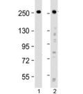 Western blot testing of human 1) HeLa and 2) SH-SY5Y cell lysate with ROBO1 antibody at 1:2000. Expected molecular weight: ~181/250 kDa (unmodified/glycosylated).