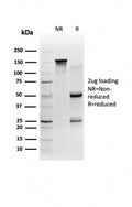 SDS-PAGE analysis of purified, BSA-free 58K Golgi protein antibody (clone FTCD/357) as confirmation of integrity and purity.