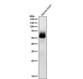 Western blot testing of mouse brain tissue lysate with Phospho-Chk2 (Ser33/Ser35) antibody at 1:1000 dilution for 1 hour at room temperature. Predicted molecular weight ~61 kDa.