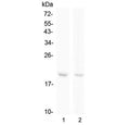 Western blot testing of human 1) Raji and 2) Jurkat cell lysate with BCMA antibody at 0.5ug/ml. Expected molecular weight: 20-27 kDa depending on glycosylation level.