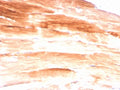 IHC staining of FFPE skeletal muscle with Dystrophin antibody (clone DMD/3245). HIER: boil tissue sections in pH6, 10mM citrate buffer, for 10-20 min and allow to cool before testing.
