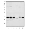Western blot testing of 1) human HeLa, 2) human K562, 3) human Jurkat, 4) rat liver, 5) rat C6 and 6) mouse liver tissue lysate with RAD51 antibody. Expected molecular weight ~37 kDa.