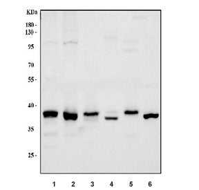 Western blot testing of 1) human HeLa, 2) human K562, 3) human Jurkat, 4) rat liver, 5) rat C6 and 6) mouse liver tissue lysate with RAD51 antibody. Expected molecular weight ~37 kDa.