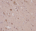 IHC testing of FFPE human brain tissue with VDAC2 antibody. HIER: steam section in pH6 citrate buffer for 20 min and allow to cool prior to staining.