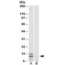 Western blot testing of human gastrointestinal cancer lysate and p15 INK4b antibody at 1ug/ml with [B] and without [A] immunizing peptide. Predicted/observed molecular weight: ~12kDa (isoform 2).