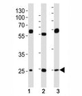 Western blot analysis of lysate from (1) HeLa, (2) HepG2 and (3) U-2OS cell line using TFAM antibody at 1:1000. Expected molecular weight: 24~29 kDa.