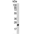 Western blot testing of human Y79 cell lysate with PBP antibody. Predicted molecular weight ~21 kDa.