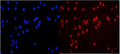 Immunofluorescent staining of FFPE human U-2 OS cells with MCM3 antibody (red) and DAPI nuclear stain (blue). HIER: steam section in pH6 citrate buffer for 20 min.