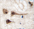 IHC analysis of FFPE human brain tissue stained with MEF2C antibody