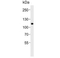 Western blot testing of human WiDr cell lysate with CARD6 antibody. Predicted molecular weight ~116 kDa.