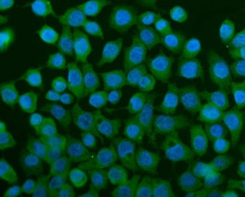 Immunofluorescent staining of FFPE human Caco-2 cells with TCP1 alpha antibody (green) and DAPI nuclear stain (blue). HIER: steam section in pH6 citrate buffer for 20 min.