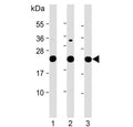 Western blot testing of 1) human HeLa, 2) human K562 and 3) rat PC-12 cell lysate with LZIC antibody. Predicted molecular weight ~21 kDa.