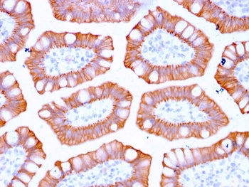 IHC staining of FFPE human colon with recombinant CK20 antibody (clone KRT20/3129R). HIER: boil tissue sections in pH 9 10mM Tris with 1mM EDTA for 20 min and allow to cool before testing.