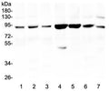 Western blot testing of 1) human HeLa, 2) (h) THP1, 3) (h) A549, 4) monkey COS-7, 5) (h) Caco-2, 6) (h) K562 and 7) (h) HL-60 lysate with Gelsolin antibody at 0.5ug/ml. Predicted molecular weight ~86 kDa.