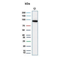Western blot testing of human small intestine tissue lysate with recombinant CDH17 antibody. Predicted molecular weight ~92 kDa but may be observed at higher molecular weights due to glycosylation.