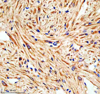 Immunohistochemical analysis of Lims1 protein using Zebrafish Lims1 antibody and paraffin-embedded zebrafish heart tissue. HIER: boil tissue sections in pH8 EDTA for 20 min and allow to cool before testing.