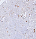 IHC staining of FFPE human uterus tissue with CD34 antibody (clone CD34/7717). HIER: boil tissue sections in pH 9 10mM Tris with 1mM EDTA for 20 min and allow to cool before testing.
