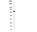Western blot testing of HIF-3 alpha antibody and rat brain tissue lysate. Expected/observed size ~72KD