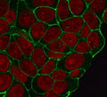 Immunofluorescent staining of human HeLa cells with recombinant Beta Catenin antibody (clone CTNB1-1R, green) and Reddot nuclear stain (red).