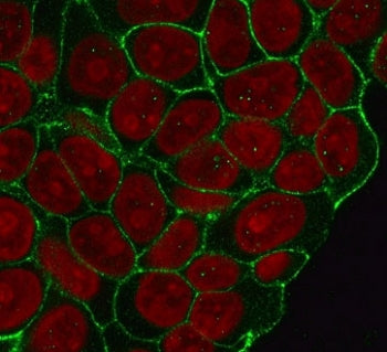 Immunofluorescent staining of human HeLa cells with recombinant Beta Catenin antibody (clone CTNB1-1R, green) and Reddot nuclear stain (red).