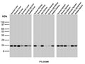 Ferritin Light Chain Antibody for WB Multi-Species. Western blot analysis of human, mouse, rat, hamster, guinea pig, and rabbit liver, kidney, and spleen tissue lysates using Ferritin Light Chain Antibody detects prominent bands at ~ 20-24 kDa across most tested species and tissue samples, consistent with ferritin light chain / FTL.