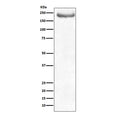 Western blot testing of human brain lysate with NF-H antibody. Predicted molecular weight ~200 kDa.