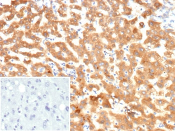 IHC staining of FFPE human liver tissue with KNG1 antibody (clone KNG1/7422). Inset: PBS used in place of primary Ab (secondary Ab negative control). HIER: boil tissue sections in pH 9 10mM Tris with 1mM EDTA for 20 min and allow to cool before testing.