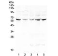 Western blot testing of human 1) placenta, 2) Caco-2, 3) CCRF-CEM, 4) HeLa and 5) Jurkat lysate with LUM antibody at 0.5ug/ml. Expected moleculer weight: ~40 kDa (unmodified), ~60 kDa (glycosylated).