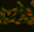 Immunofluorescent staining of FFPE human HeLa cells with Histone H1.10 antibody (red) and Beta Tubulin mAb (green). HIER: steam section in pH6 citrate buffer for 20 min.