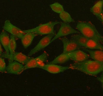 Immunofluorescent staining of FFPE human HeLa cells with Histone H1.10 antibody (red) and Beta Tubulin mAb (green). HIER: steam section in pH6 citrate buffer for 20 min.