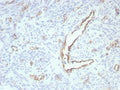 IHC staining of FFPE human uterus tissue with recombinant PECAM antibody (clone rPECAM1/8826). HIER: boil tissue sections in pH 9 10mM Tris with 1mM EDTA for 20 min and allow to cool before testing.
